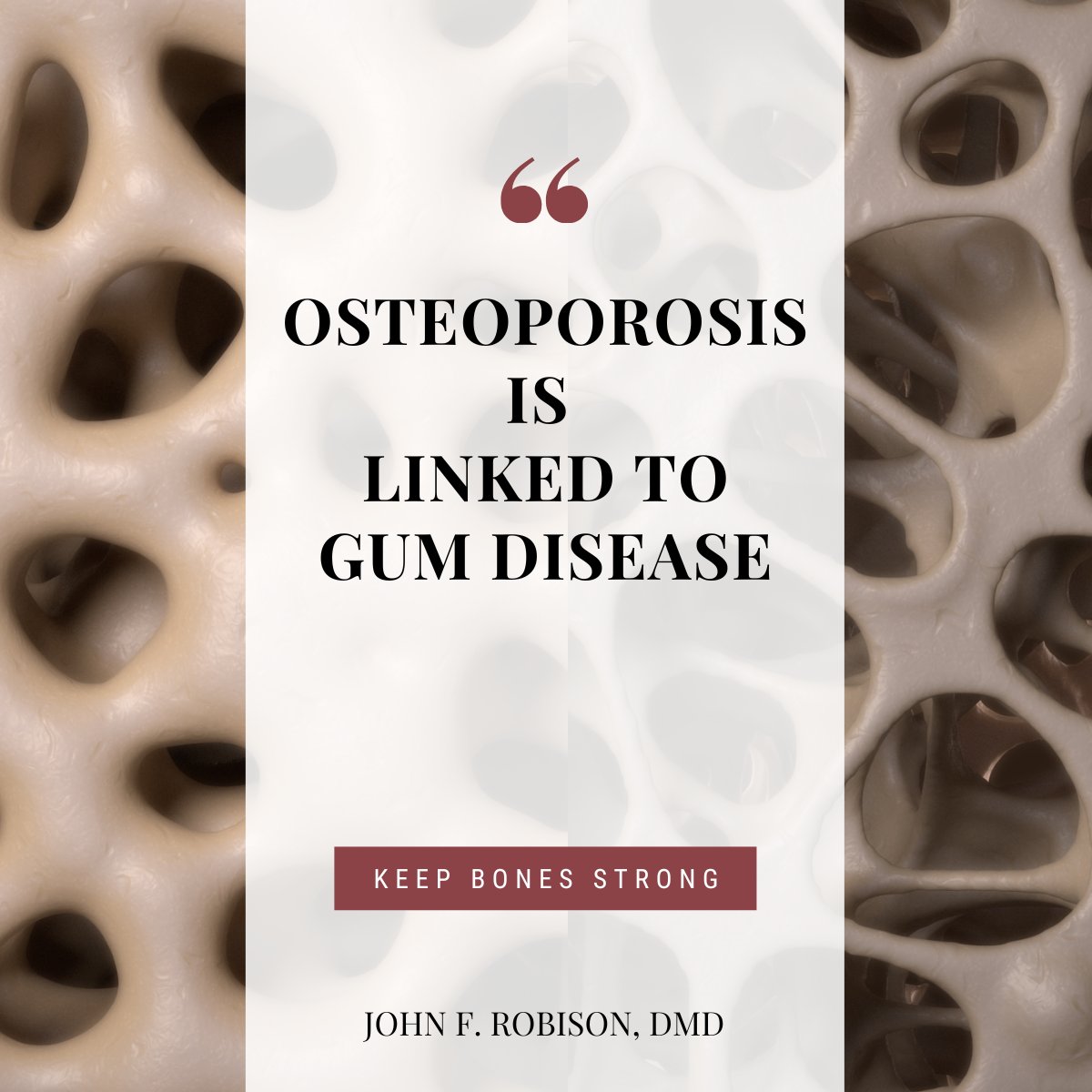 #wellnesswednesday Osteoporosis is a bone-weakening disease and is linked with periodontal bone loss and tooth loss. Exercising, eating calcium-rich foods, and of course, visiting your dentist can help. Schedule an appointment today. ow.ly/9XOf30soQal