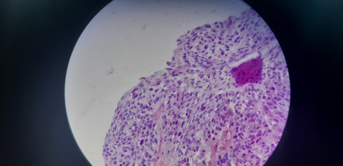 PathDiff tweet picture