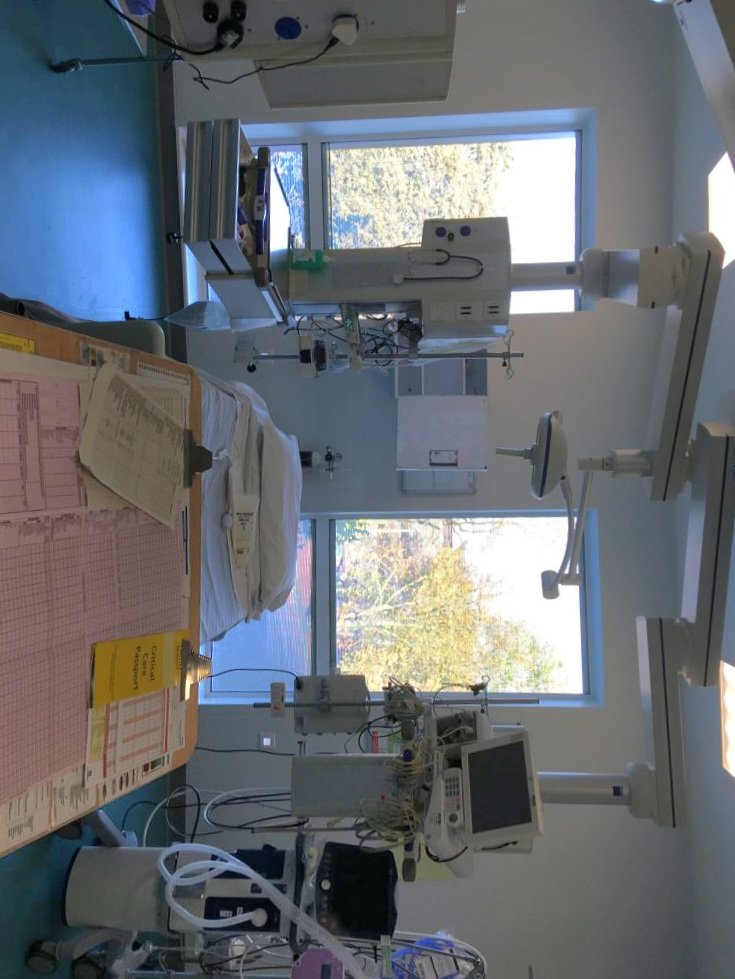 saracrosland's tweet photo. Do not adjust your screen!!
Thinking of the days immediately after my op when this is how my world looked.
For 48 hrs I clung onto the side of my bed, terrified that 1. I was going to fall out of it and 2. They'd need to crack me open again.
#AcousticNeuroma #SickbedToSummits https://t.co/5aiotZ0meF