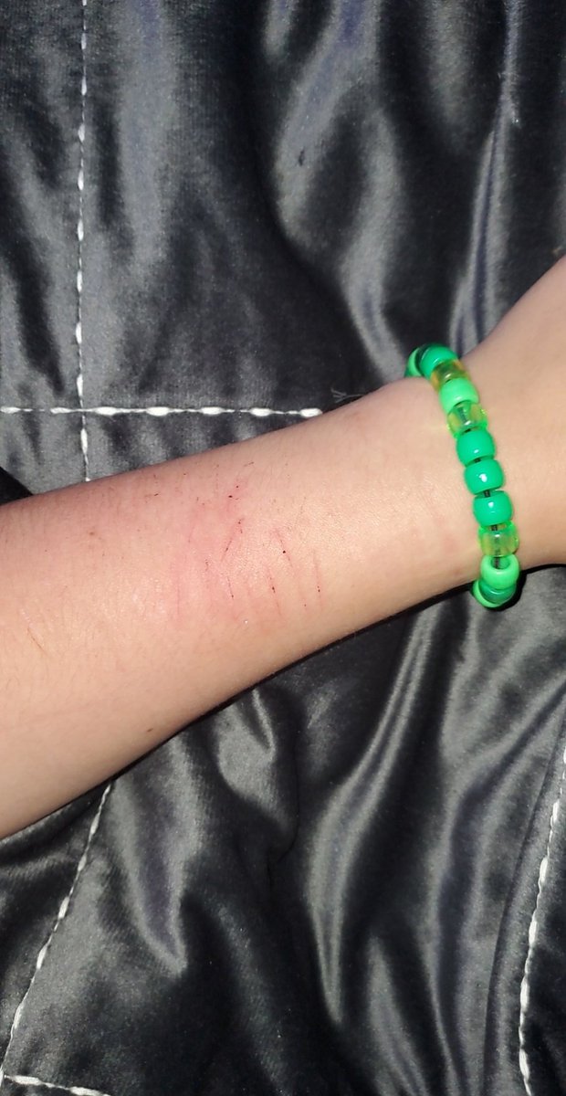 __lifesupport's tweet photo. #shtwtw #sh
#selfharm #Imdepressed
#manic #trigger
#cutting
#smallcuts
#notdeep
Small, I'm trying to work up to getting bigger cuts again, it will happen eventually https://t.co/JQdp0xbfnI