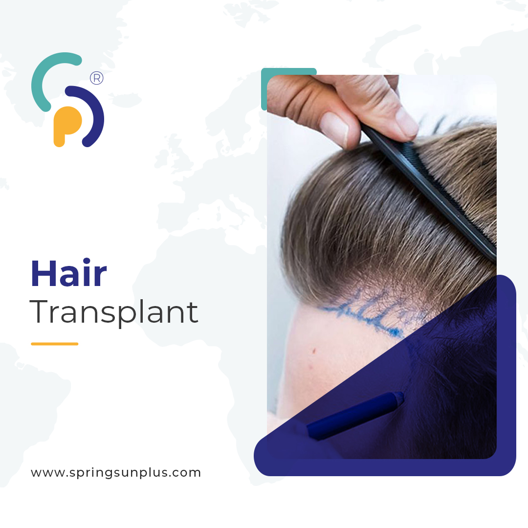 springsunplus's tweet photo. There are several basic techniques used in hair transplantation:
📌FUE Technology
📌FUT Technology
📌DHI Technology
Ask your questions about hair transplantation
📞 +44 758 402 4458
🌐 https://t.co/igdo1L94MF
#hairtransplantation #hairtransplantation #haartransplantation https://t.co/mfM62efOWZ