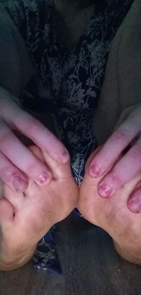 aubreyscorner2's tweet photo. Adore me pet. That's the only thing you do right. Your obsession makes me wet, and your money makes me cum.
#nsfwtw #footfetısh #palefeet #onlyfansgirl #onlyfansbabe #onlyfanspromo #feet #feetworship #femdom #footsugar #RETWEEET #nsfwxRolePlay https://t.co/agptRvdZyP