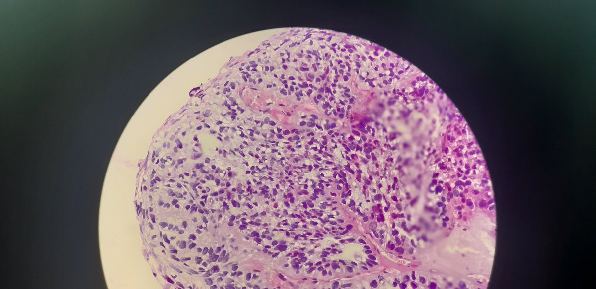 PathDiff tweet picture
