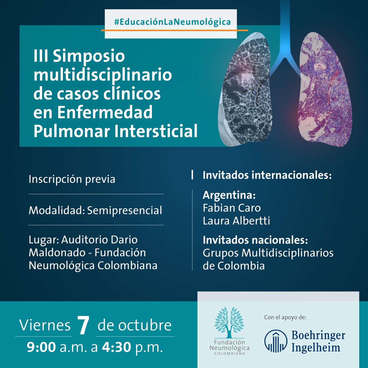 EmyRincon's tweet photo. Próximamente mis amigos de #Intersticio en Colombia 🇨🇴 @FabianCaro1981 @laualberti1 y equipos multidisciplinarios @Isapalaciosmd @arbelaez_cortes @pablogilto @pulmonology101 @aguirrefrancoc #EPID #FPI https://t.co/drFBnjBpBs