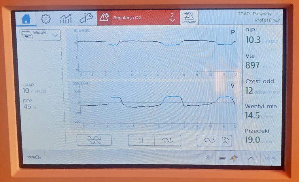 usgzrm's tweet photo. Another patient with HAPE. Interview, clinic and ultrasound. #cpap #philipsPOCUS #mountain #emergency https://t.co/Xm3xtgCNLg