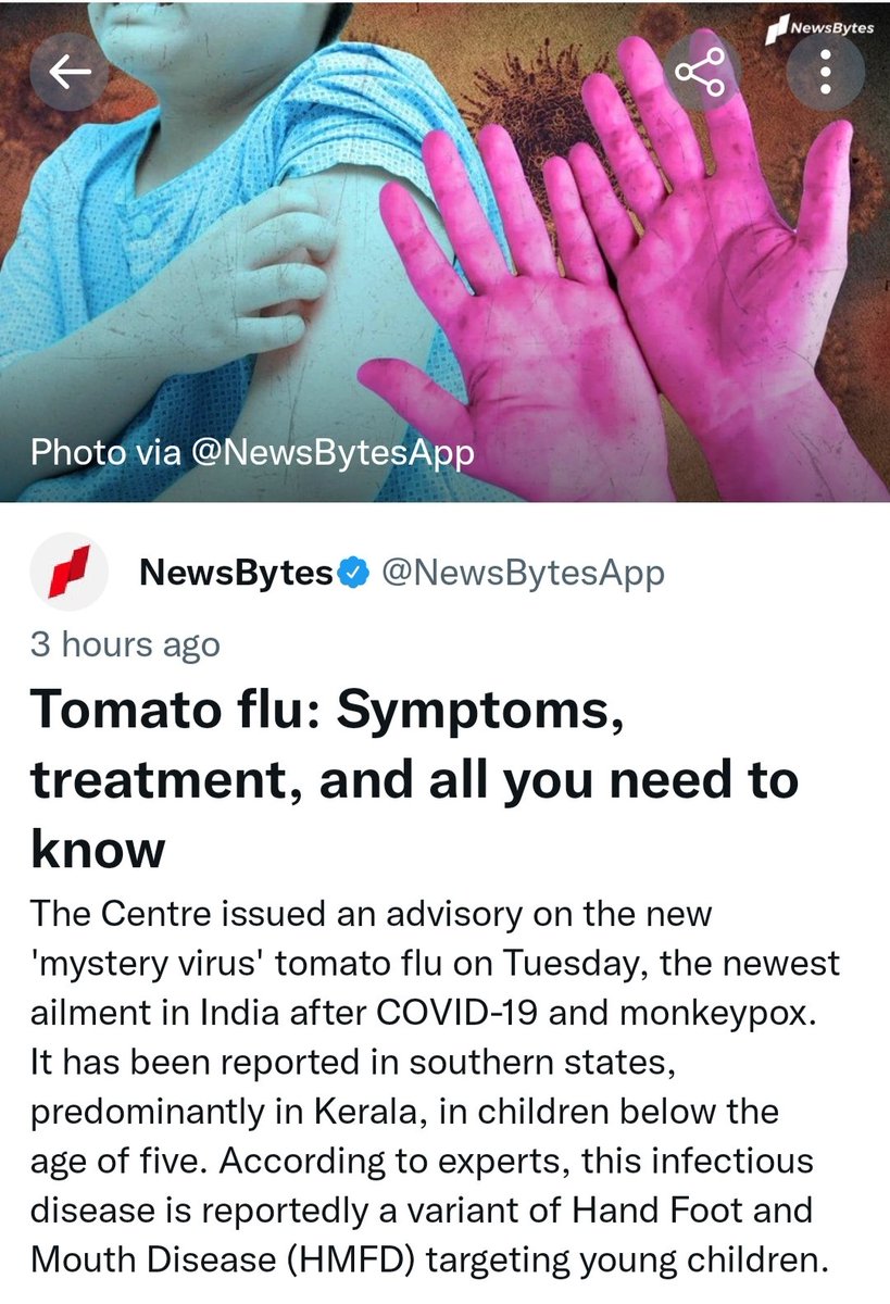 PhysioeaseT's tweet photo. Another virus after covid -19 and monkeypox #monkeypox #virus #Covid #healthy #health https://t.co/EKUvaB0oz7