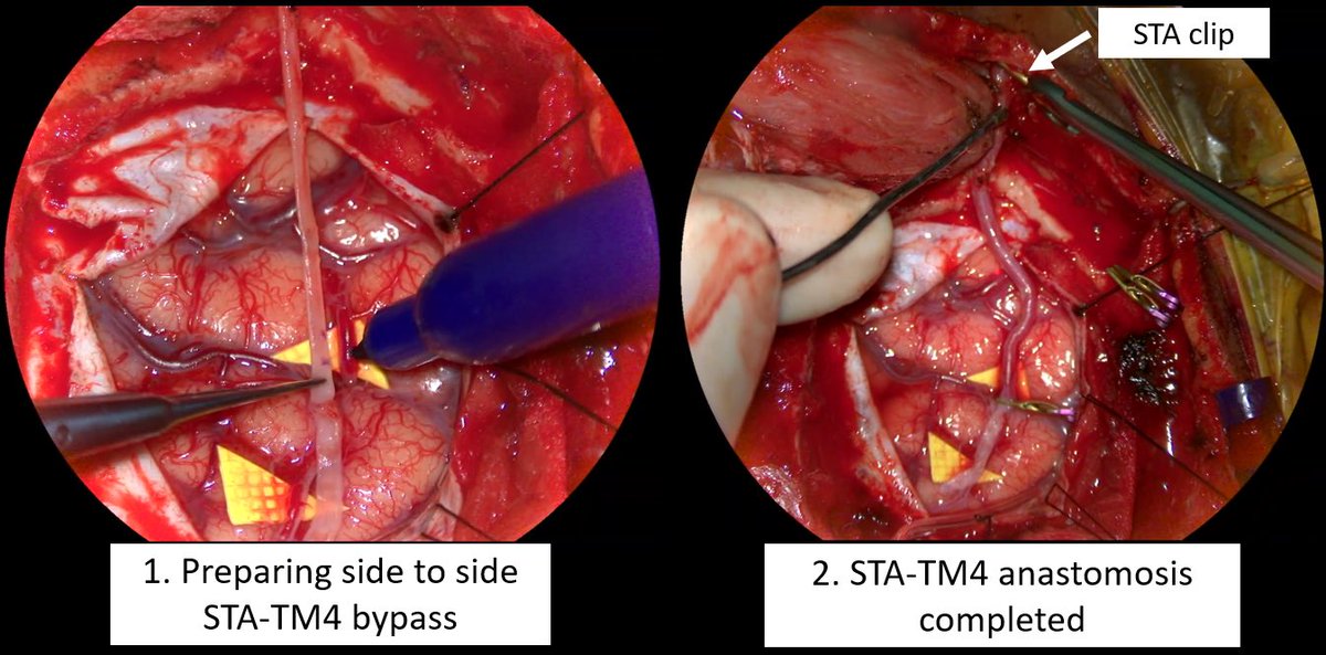Jacques Morcos MD FRCS FAANS tweet media