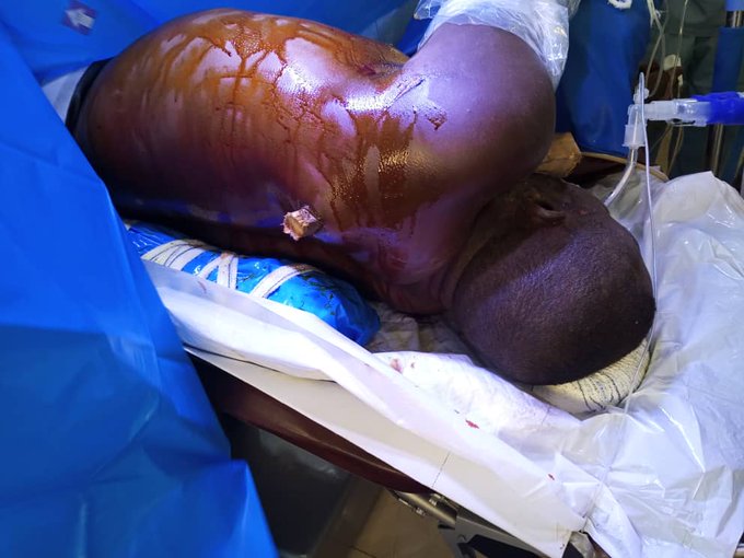 DrJohnAfam's tweet photo. Remember when this happened in FMC Abeokuta?
The Nigerian Doctors in Nigeria dont get enough credit!! https://t.co/O2sACb106G