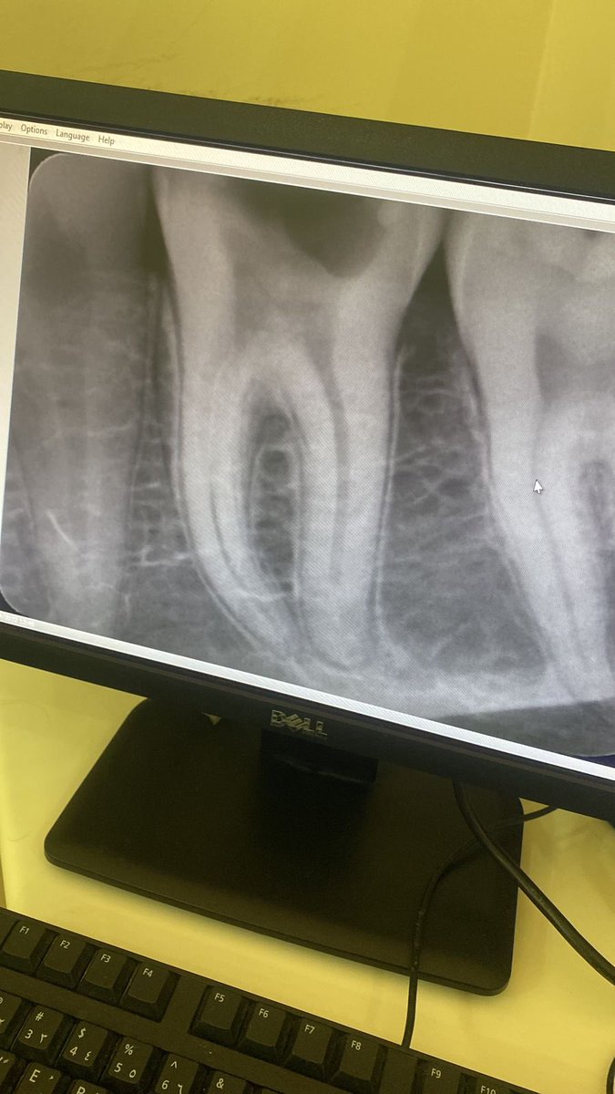 Mohammad Alotaibi tweet media