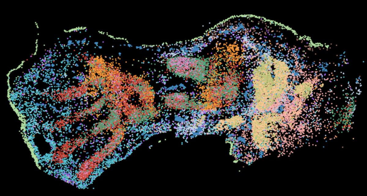 Omer Ali Bayraktar (@bayraktar_lab) on Twitter photo we are recruiting multiple positions for my lab's glioblastoma work w <a href="/WellcomeLeap/">Wellcome Leap</a> and our spatial genomics work at <a href="/sangerinstitute/">Wellcome Sanger Institute</a> - please see below and share! we are recruiting multiple positions for my lab's glioblastoma work w <a href="/WellcomeLeap/">Wellcome Leap</a> and our spatial genomics work at <a href="/sangerinstitute/">Wellcome Sanger Institute</a> - please see below and share!