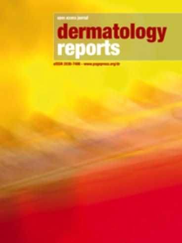 PagePgp's tweet photo. As you may already know, our journal has been included in the #Clarivate’ ESCI. In accordance with Clarivate's recent announcement, we anticipate receiving our first official #impact_factor in June 2023.
#DermatologyReports https://t.co/vCARFut367 https://t.co/wox9SFa1x7