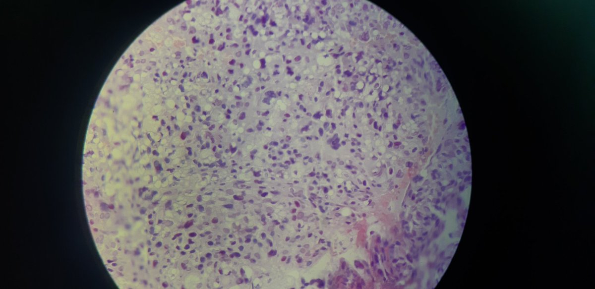 PathDiff tweet picture
