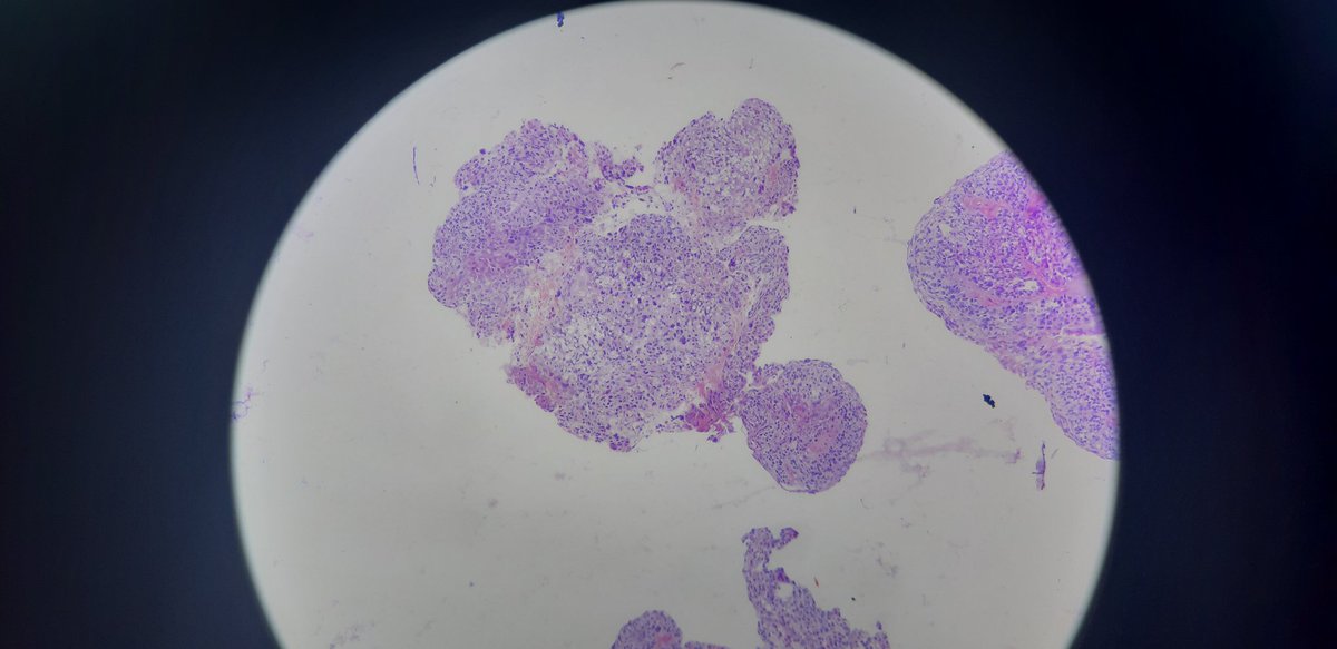 PathDiff tweet picture