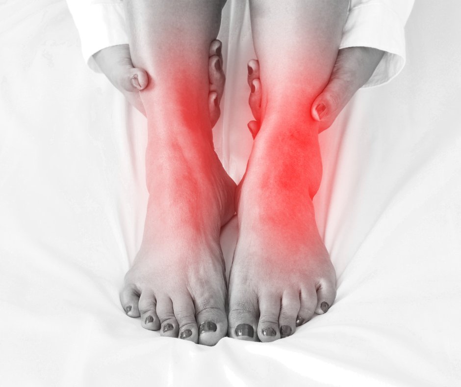 Class IV #lasertherapy is one of the safest and most effective ways to treat various conditions that cause #foot and #ankle pain! If you want relief from your #footandanklepain, learn more here, then contact #DrAnthonyWeinert: bit.ly/3Naz5y8

#footdoctorTroyMI
