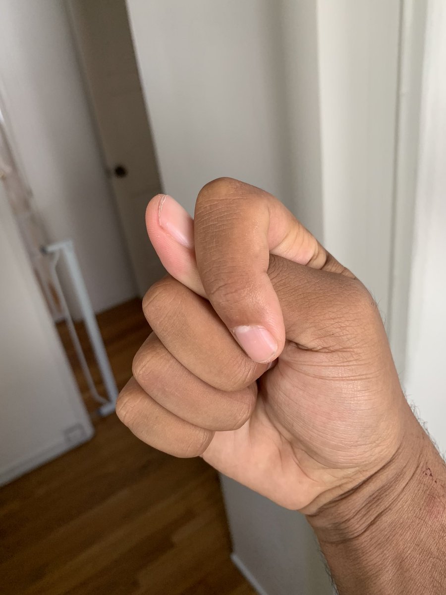 BREAKING: Sources report Andrew Tate has lost his nose