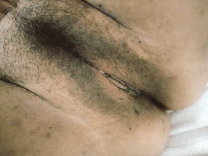 Hairy fat pussy begging to be used #hairytaco #hairychicks #hairy #onlyfans #onlyfansgirl #onlyfanspromo<a href="/tag/hairytaco"class="tags">#hairytaco</a><a href="/tag/bbw"class="tags"><span>#bbw</span></a><a href="/tag/fat"class="tags"><span>#fat</span></a><a href="/tag/worship"class="tags"><span>#worship</span></a><a href="/tag/hairy"class="tags"><span>#hairy</span></a><a href="/tag/pussyworship"class="tags"><span>#pussyworship</span></a><a href="/tag/bodyworship"class="tags"><span>#bodyworship</span></a>