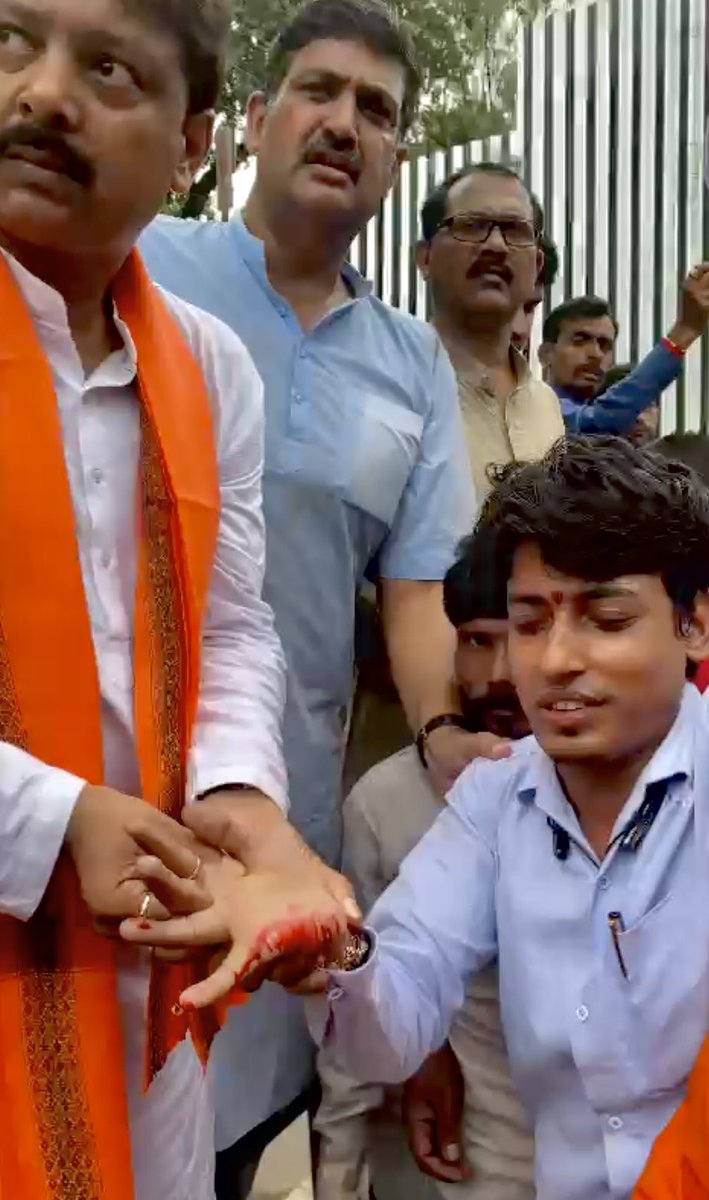 AlokDangas's tweet photo. . @BJYM  कार्यकर्ताओं पर बर्बरता , @bhupeshbaghel हर खून के कतरे का हिसाब होगा हमारा संघर्ष जारी रहेगा !@Tejasvi_Surya @BJYM @INCIndia https://t.co/x2bnd7XseX