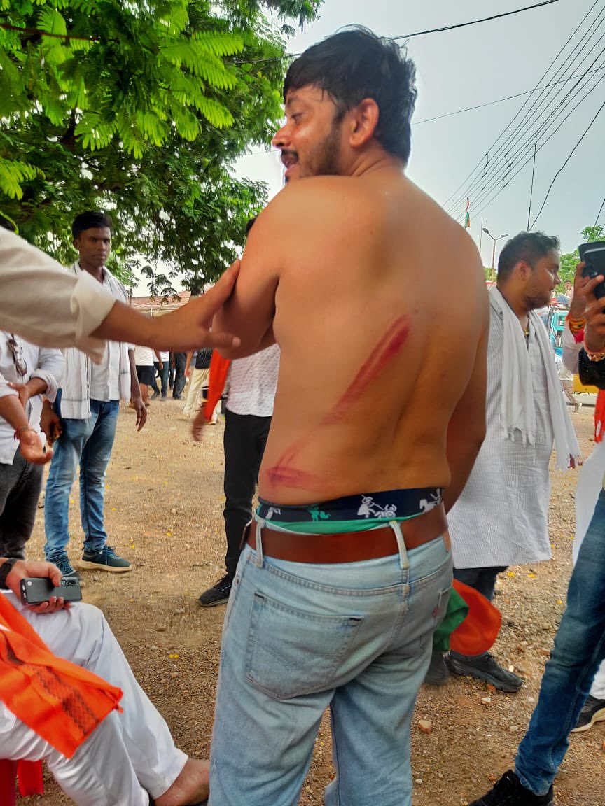 AlokDangas's tweet photo. . @BJYM  कार्यकर्ताओं पर बर्बरता , @bhupeshbaghel हर खून के कतरे का हिसाब होगा हमारा संघर्ष जारी रहेगा !@Tejasvi_Surya @BJYM @INCIndia https://t.co/x2bnd7XseX