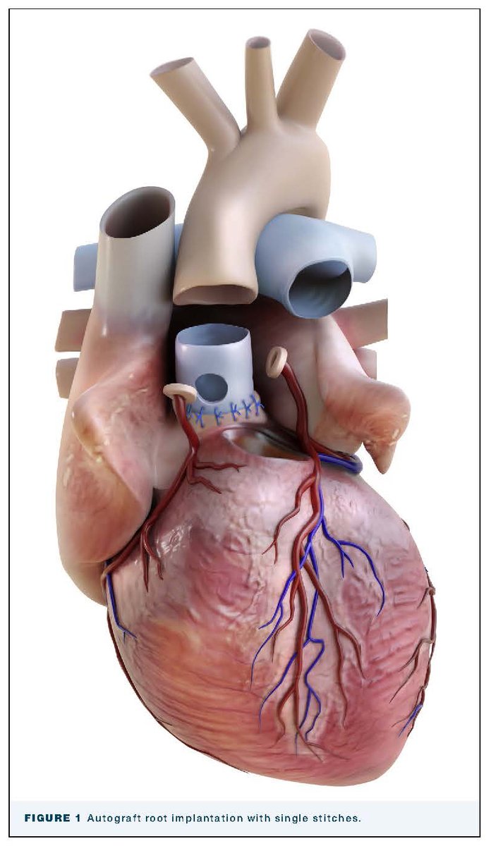 The Annals of Thoracic Surgery tweet media