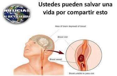 RAUL429's tweet image. CÓMO ACTUAR ANTE UN DERRAME CEREBRAL:
Importante, revisa y Comparte!.. Tecnología Médica.

Si todo el mundo puede recordar algo tan simple, podría salvar a algunas personas.

IDENTIFICACIÓN DE LOS TIEMPOS:
Durante una fiesta, una amiga tropezó y se cayó poco -