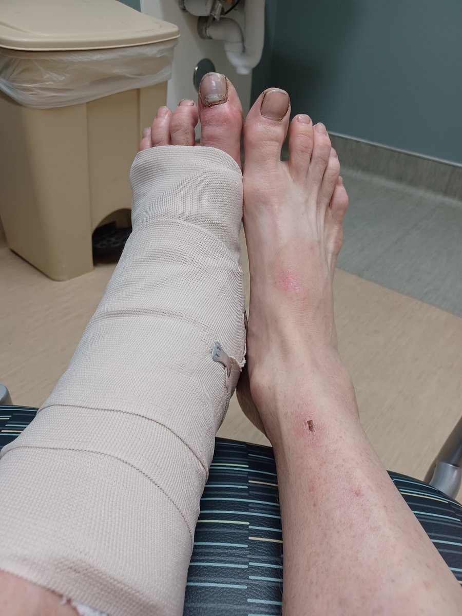 RtotheTtotheC's tweet photo. #SetAReminderFor not hurting yourself.
@TagsTitanium
@NylonDragon
@LeeAnndelCastil
@elizabethk1985
@teatime75
@Acidic_Blonde
@LovesTheStars_
@HashtagRoundup https://t.co/qxjiHMrcHU