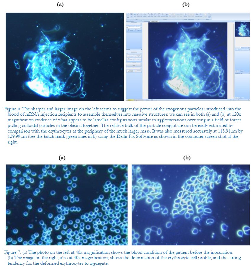 Dune on twitter rt 2019 ncov analyse microscopique en champ