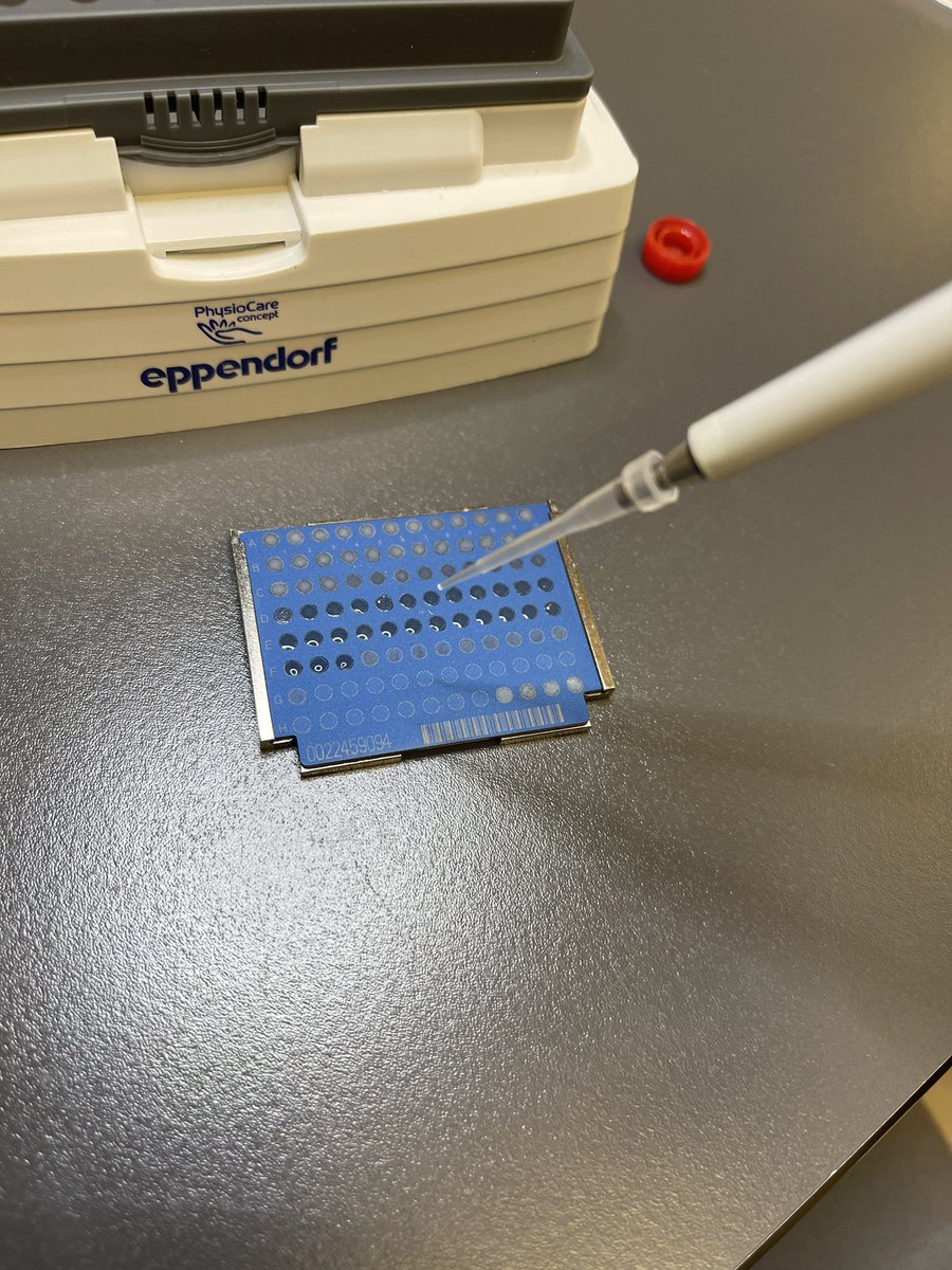Fernand84340182's tweet photo. It can be “just an ordinary day” for you, but for me, a PGY-1, this experience in a very modern micro lab is a dream come true! It’s hard to believe we can get bacteria ID in seconds 😱 #pathology #PathTwitter #clinicalpath #maldi https://t.co/rStc2H3IMp
