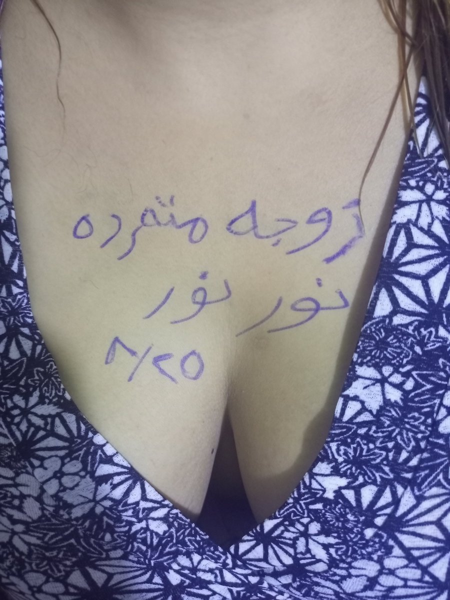 الوضع حاليا ...مباشر