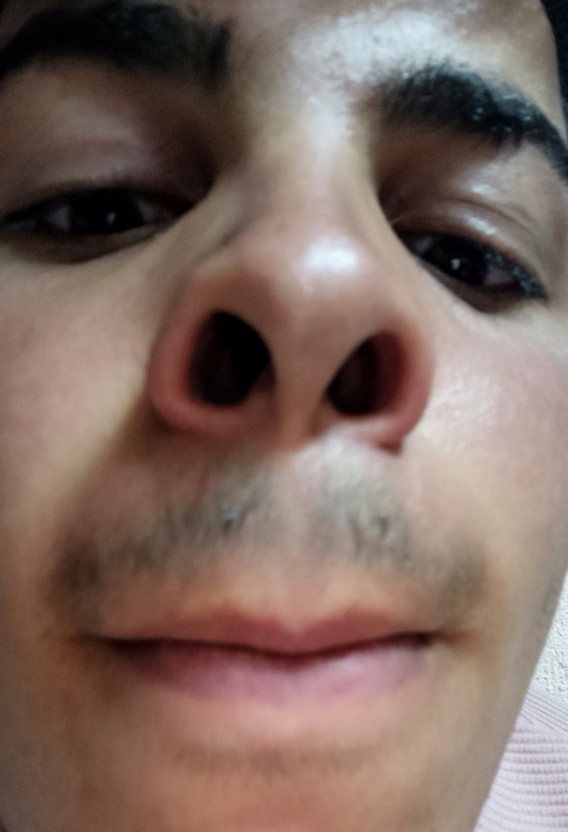 Gece gece galerimde şöyle bir şey çıktı 😅😮‍💨🫣
#Kardeşterörü