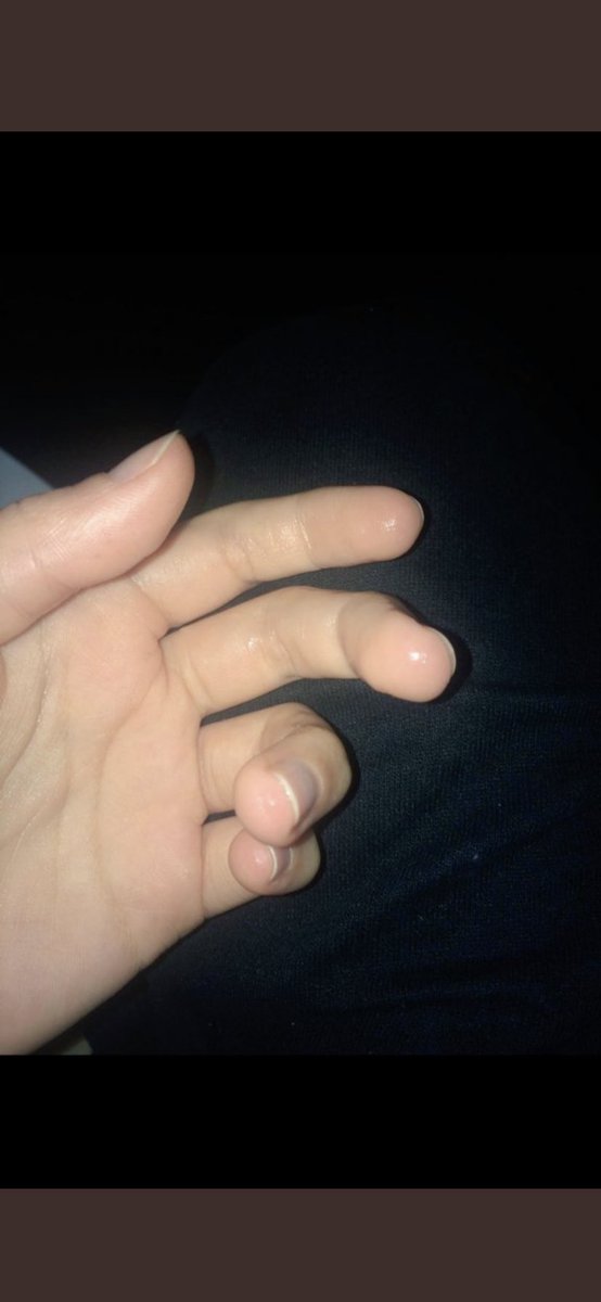 🤤👅 ıslak ıslak