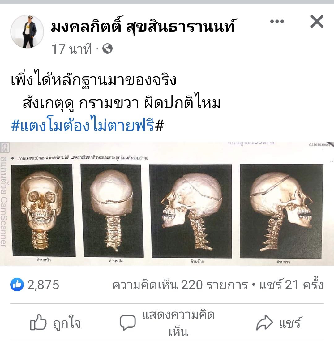 CHICKEN4651's tweet photo. ให้ภาพเล่าเรื่อง..เจ็บแค่ไหน..กัน..เครดิต..สสเต้..#แตงโมต้องได้รับความยุติธรรม https://t.co/weAV7Krjcq