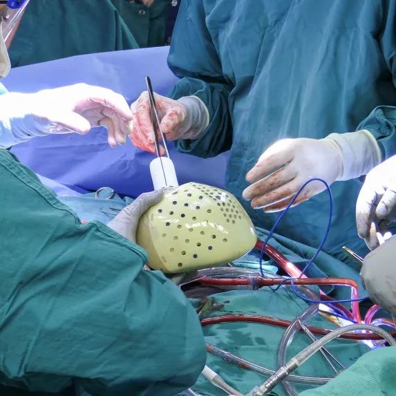 ab2kone's tweet photo. (⛑️) Voici le 1er cœur complètement artificiel a avoir été greffé avec succès ! ❤️🤖

C'était en juillet 2021 : l'hôpital universitaire de Duke a transplanté un cœur totalement artificiel chez un homme de 39 ans qui a connu une insuffisance cardiaque soudaine. https://t.co/yTkt5qHT3J