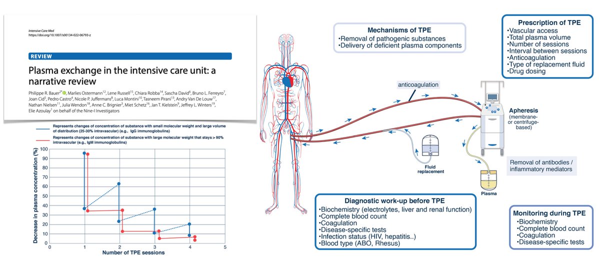 Therapeutic plasma exchange in #ICU
🟨 indications for urgent TPE
🟨 mechanisms, kinetics and therapeutic goals
🟨 diagnostic workup &amp; monitoring
🟨 technical aspects
🟨 clinical response &amp; complications
🟨 unanswered questions &amp; research agenda
#FOAMcc
📎 rdcu.be/cTAMO