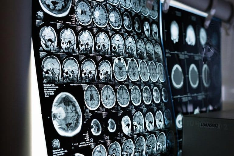 Rahim Azizian tweet media