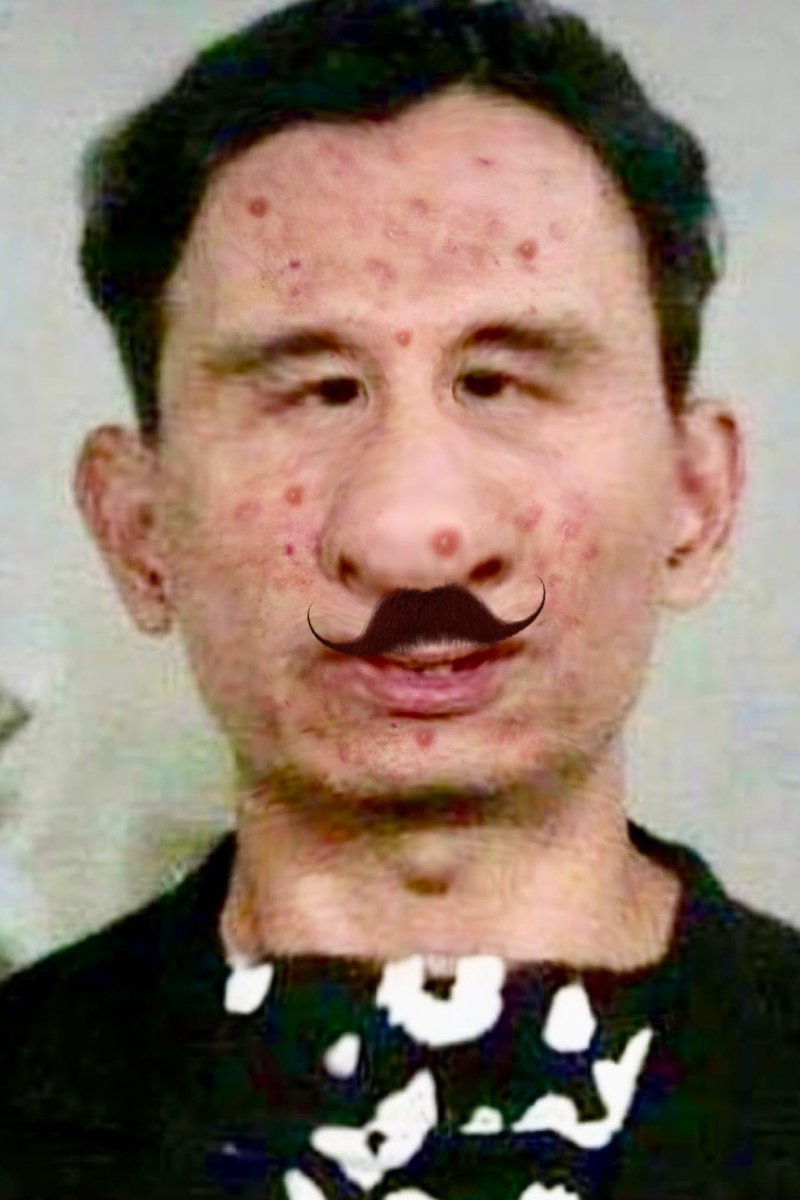 Doctor_Emperor's tweet photo. I tested positive for #monkeypox so I will be quarantining myself with PM Justine since we have been in close contact. Since the first 4 shots didn’t work, I’ll be booking 40 more while isolated. Get your boosters today and be safe. @JustinTrudeauNo #vaccination #MonkeypoxVirus https://t.co/HosAs5WzOh