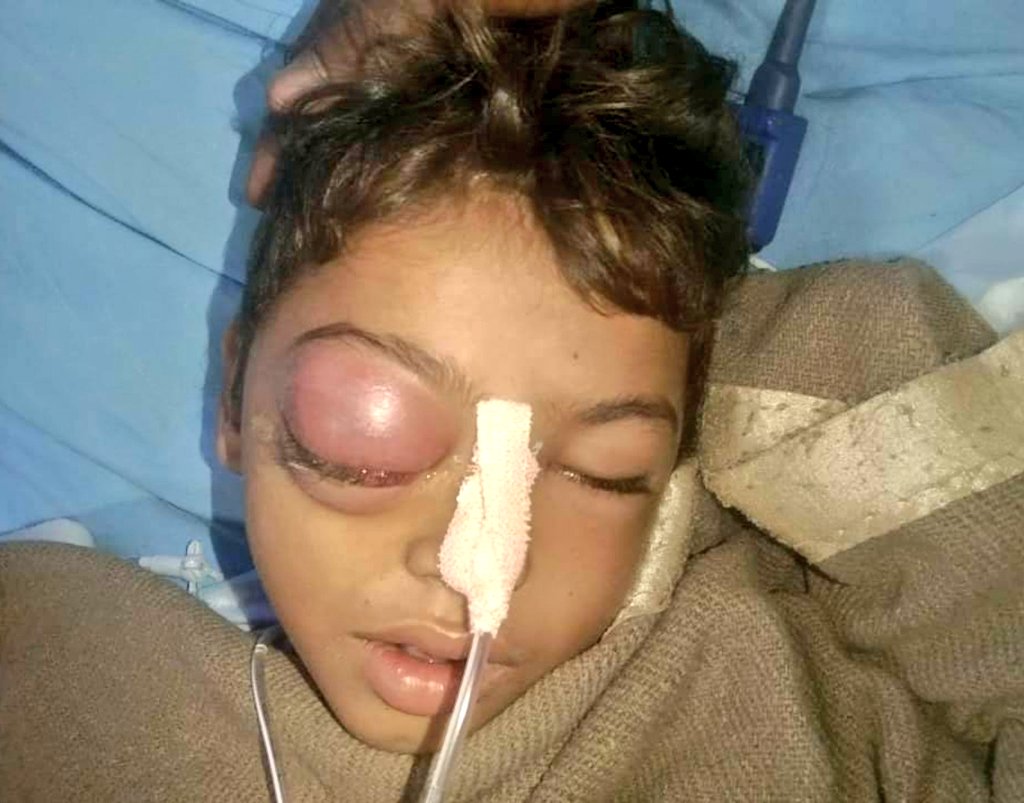 #Rajasthan
No words for this! A 9-year-old Dalit boy beaten to death allegedly by his school teacher, who got angry on seeing the boy drink water from an earthen pot (matka) meant for the upper caste

Teacher has been arrested under sec 302 of IPC &amp; relevant sections of ST SC Act