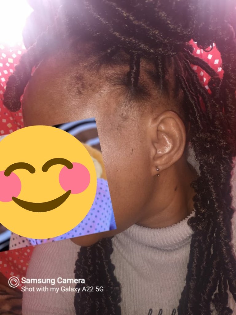 the lady says I need to show off. She is so thankful and happy.

Wow look at her skin, Godly herbs kodwa maan! 😍🍀💚🙌🏿