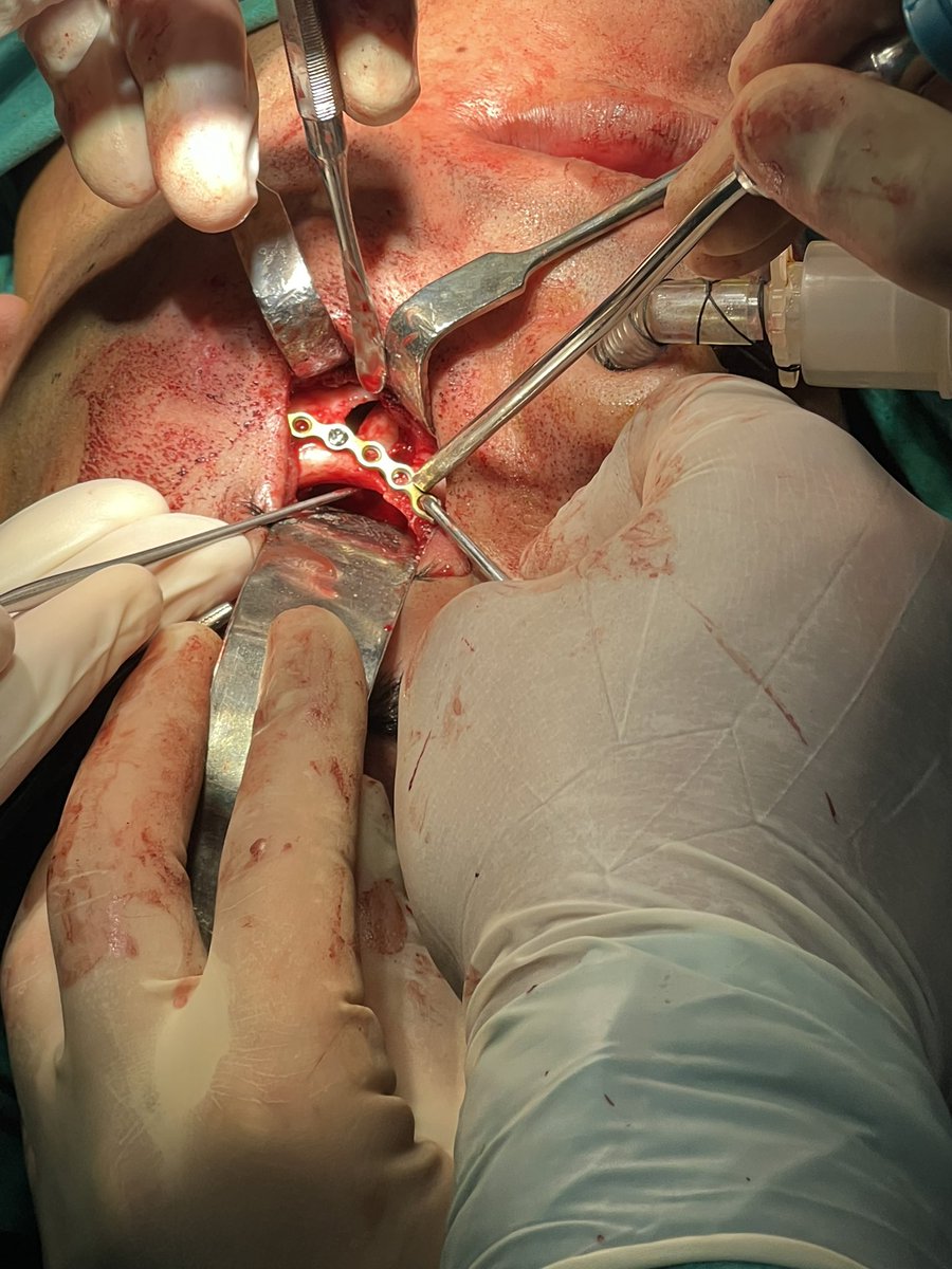 t_tjoo's tweet photo. I just love surgery 🤍✨ https://t.co/MoxOssndHu