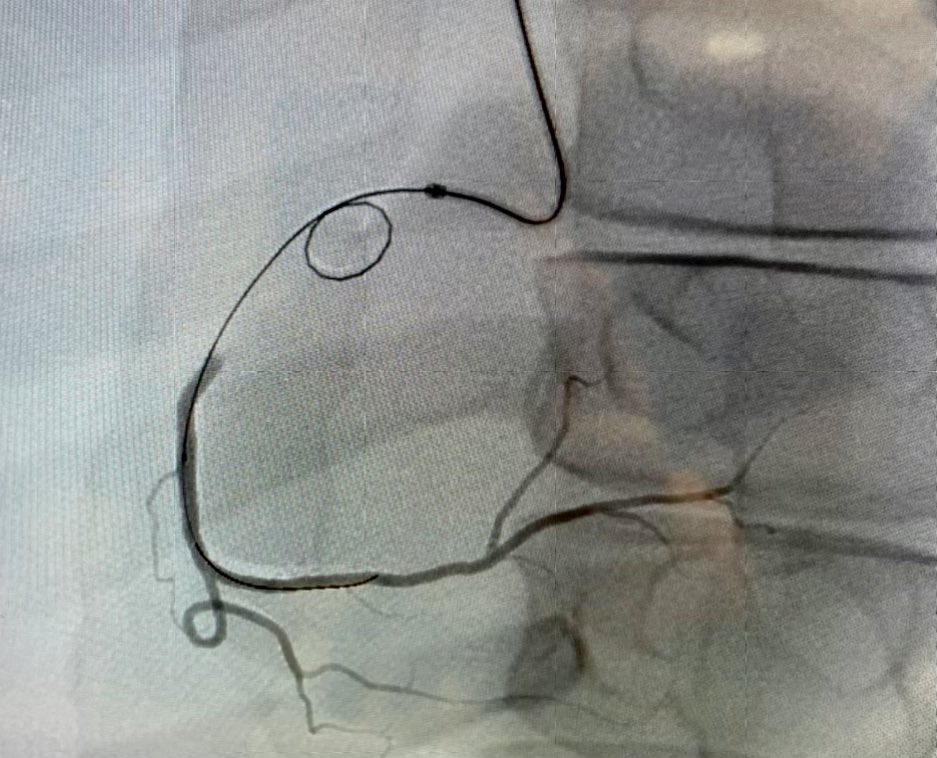 Sandeep Nathan, MD, MSc tweet media