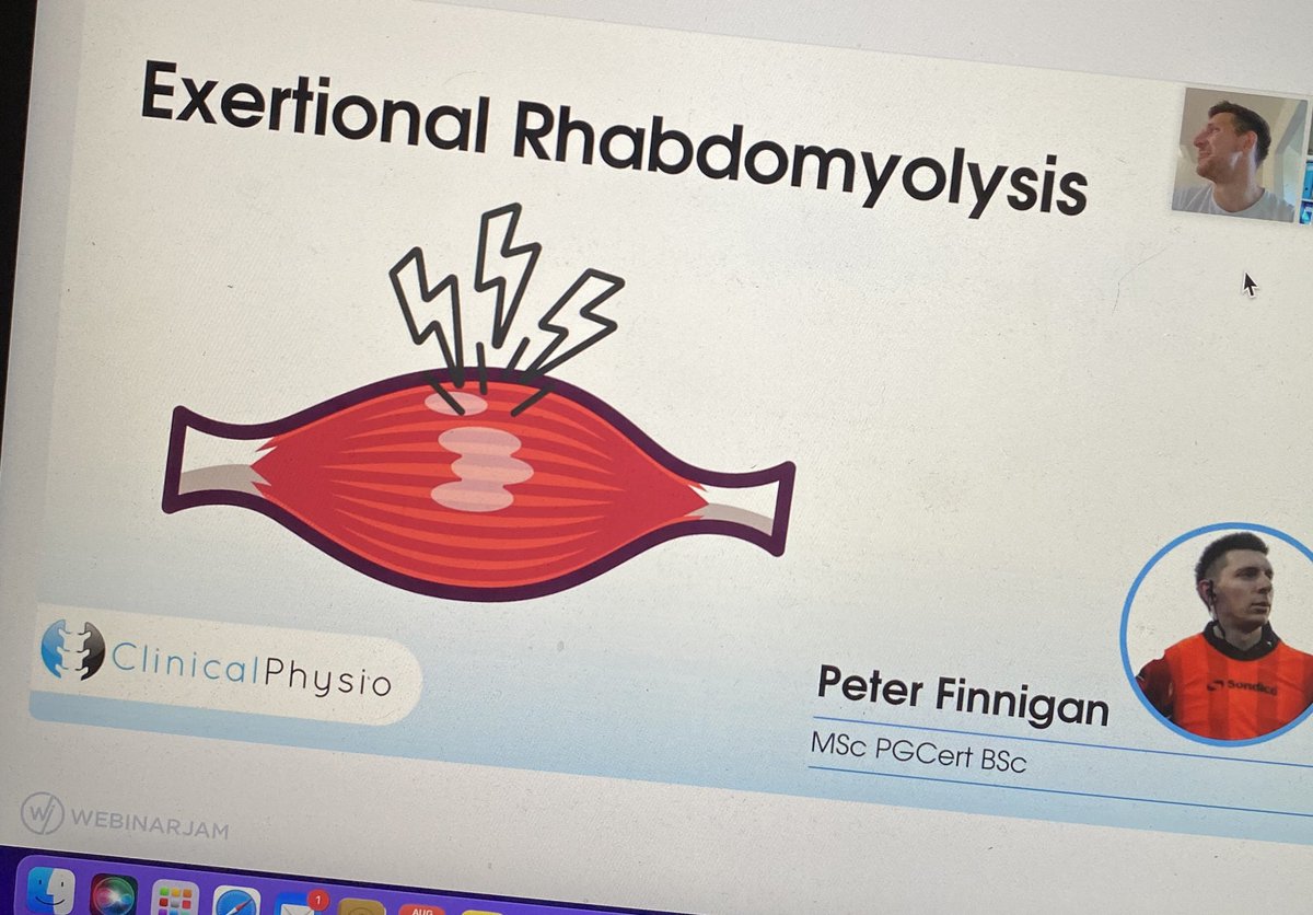 al_physio (@alphysio2) on Twitter photo #ClinicalSummit <a href="/clinicalphysio/">Clinical Physio</a> thanks for a very informative day! I have learnt so much, plus been able to refresh my knowledge. #ClinicalSummit <a href="/clinicalphysio/">Clinical Physio</a> thanks for a very informative day! I have learnt so much, plus been able to refresh my knowledge.