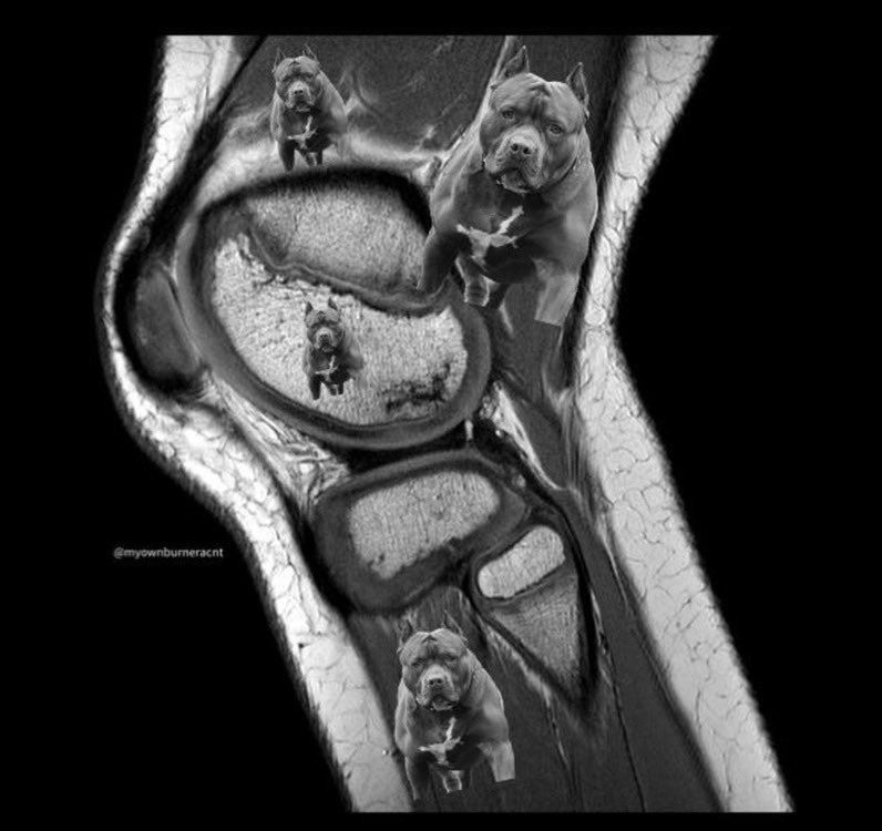 JetsLife4's tweet photo. Zach Wilson’s MRI came back looking good  #Jets https://t.co/tD7gG1pAXS