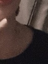 onlyNT0802's tweet photo. 그림자가 져서 그런가? 목에 이게 뭐지? 강턔혅이 깨물었니? https://t.co/1vNvwhhpmo