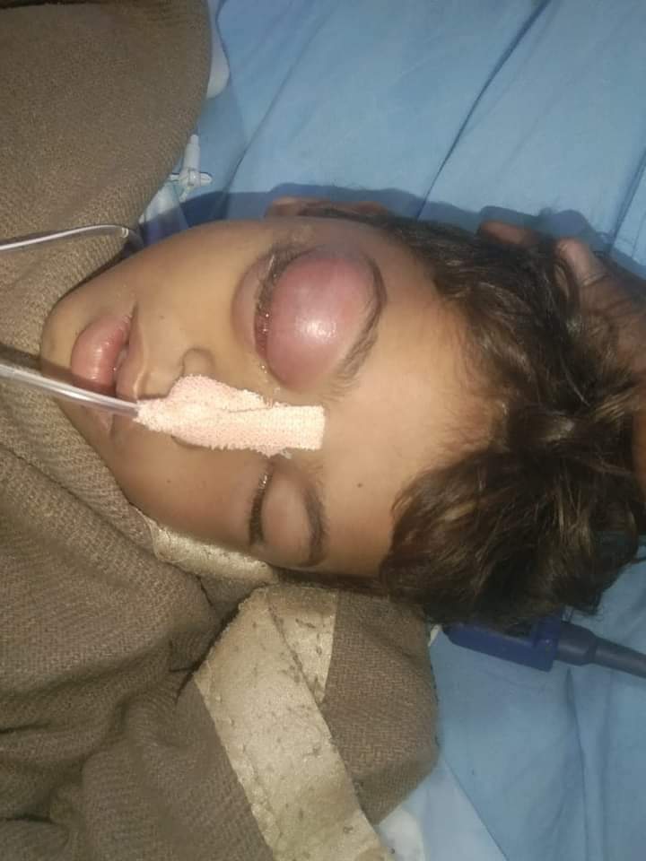 #शर्मनाक
स्कूल में मटके से पानी पीने पर जातिय मानसिकता से ग्रस्त टीचर छैलसिंह ने बच्चे को इतना मारा कि बच्चे ने इलाज के दौरान दम तोड़ दिया, मामला जालोर जिले के सुराणा गांव का है। <a href="/JalorePolice/">Jalore Police</a> आरोपी को तुरंत गिरफ्तार कर तुरंत कड़ी कार्यवाही करे।
<a href="/BhimArmyChief/">Chandra Shekhar Aazad</a>