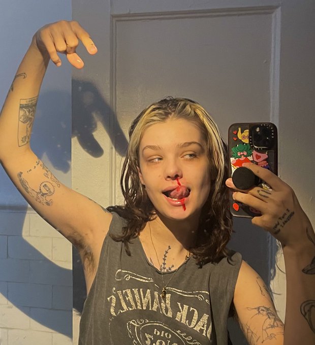you should see the other guy https://t.co/Vub5u6chQL