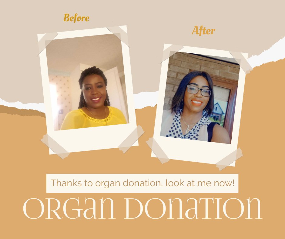 AsumuHilaria's tweet photo. On this #WorldOrganDonation day, I'll like to thank the mother of my #HeroAngel, who agreed to #OrganDonation to give me a second chance at life. ๐ถTake a look at me now.. ๐ถ looking better than I did before my transplant. Be a hero, donate today ๐https://t.co/OmMFWzLdXE https://t.co/2k8p3PdG5A