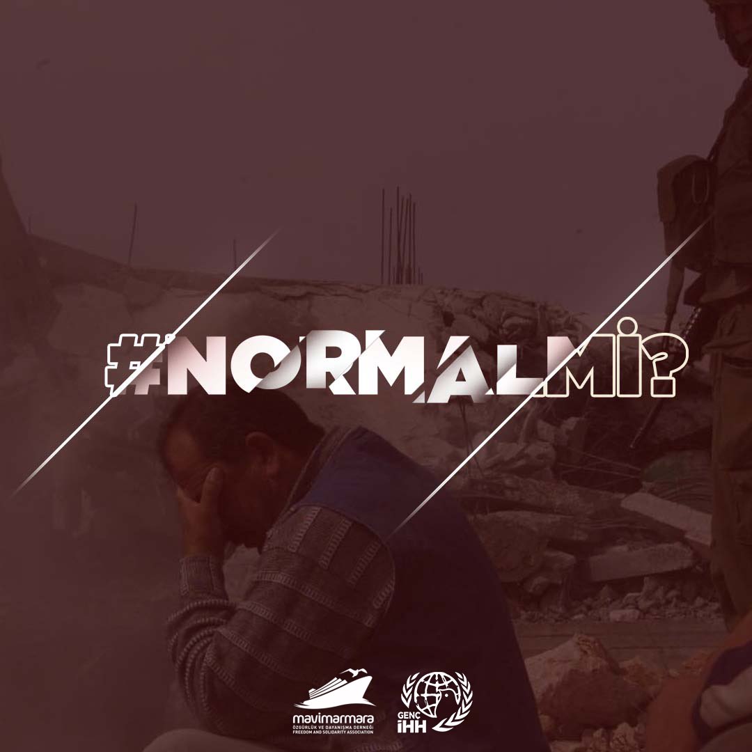 44 can kaybı #NormalMi?