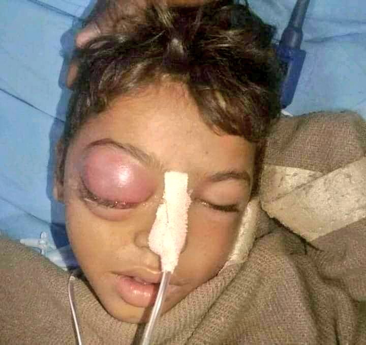 ये कैसा आज़ादी का अमृत महोत्सव जहां 75 साल बाद भी एक बच्चे को मटके से पानी पी लेने पर शिक्षक जान से मार देता है!
आजादी का अमृत महोत्सव मना रहे भारत के लिए इससे बड़ा कलंक कुछ नही हो सकता।
#HarGharTiranga 
#आज़ादी_का_अमृत_महोत्सव
#इन्द्र_कुमार_को_न्याय_दो
#अशोक_गहलोत_इस्तीफा_दो