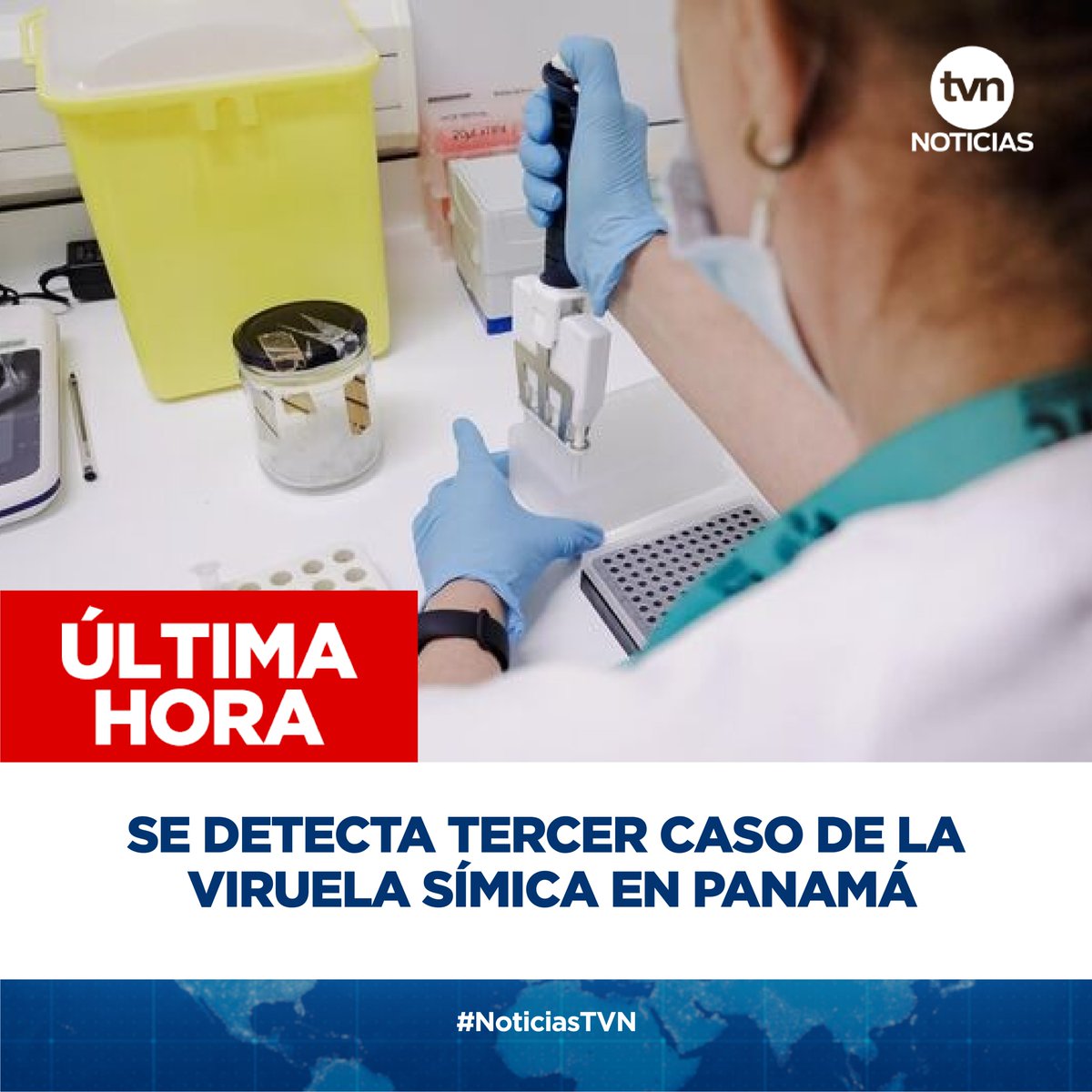 tvnnoticias's tweet photo. #ÚLTIMAHORA Se trata de un paciente masculino de 33 años con domicilio en el distrito de Arraiján, provincia de Panamá Oeste quien presentó síntomas el pasado 7 de agosto. #NoticiasTVN https://t.co/wnvChW2ab4