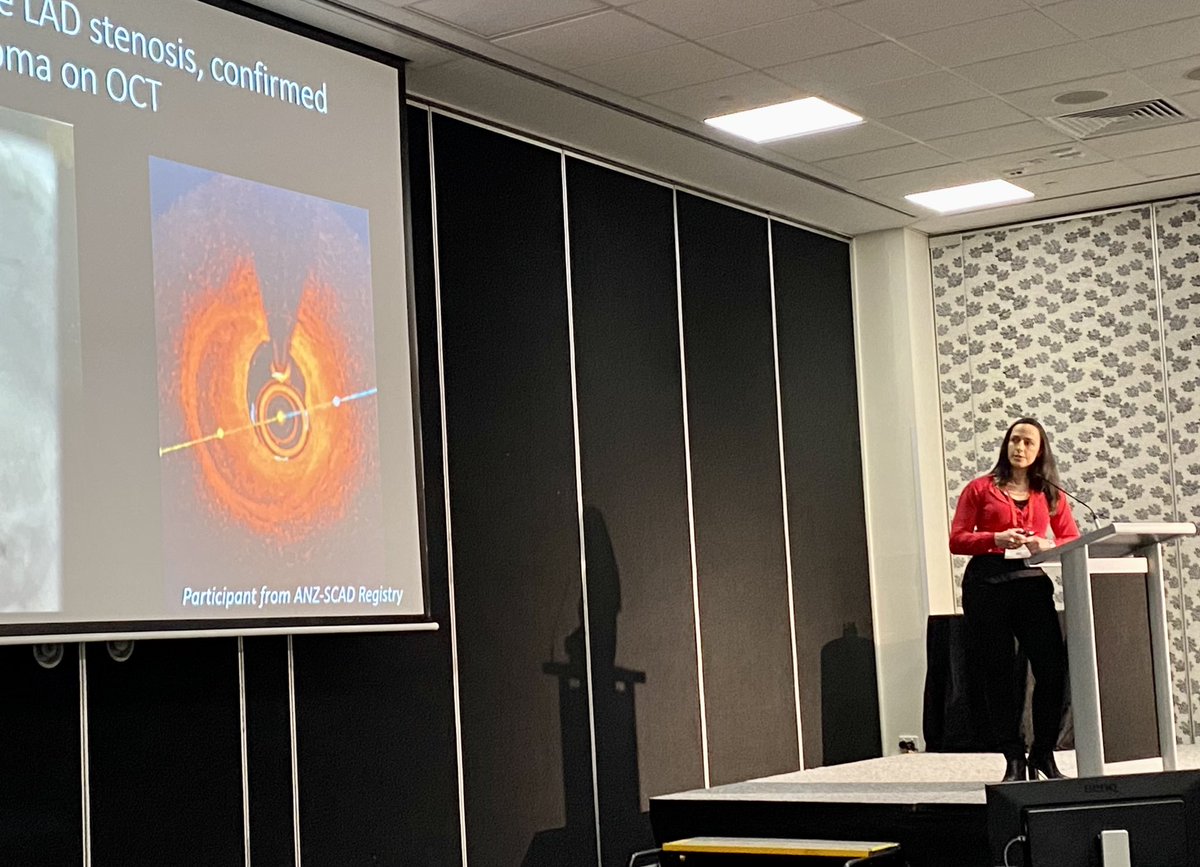 Edwina Wing-Lun (@dredwinawinglun) on Twitter photo Fantastic talk by <a href="/DrSarahjZaman/">A/Prof Sarah Zaman</a> on when to image in #SCAD <a href="/thecsanz/">CSANZ</a> #CSANZ2022 #anzet2022 <a href="/WARC_USYD/">Westmead Applied Research Centre #WARC_USYD</a> Fantastic talk by <a href="/DrSarahjZaman/">A/Prof Sarah Zaman</a> on when to image in #SCAD <a href="/thecsanz/">CSANZ</a> #CSANZ2022 #anzet2022 <a href="/WARC_USYD/">Westmead Applied Research Centre #WARC_USYD</a>