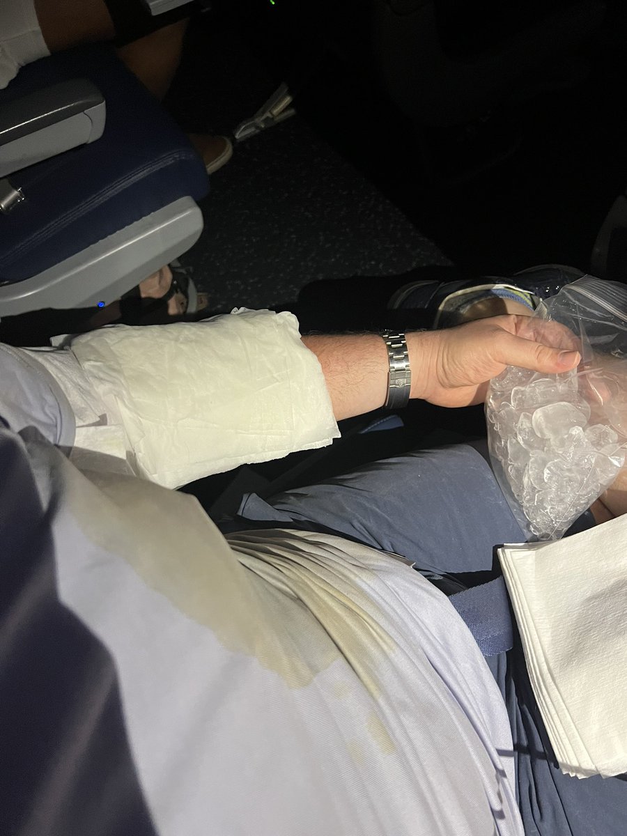 sunset_ranger's tweet photo. @Delta don’t fly delta if you don’t enjoy getting burns on your body from poorly trained flight attendants who spill hot coffee on you… https://t.co/odF4t1zHsF